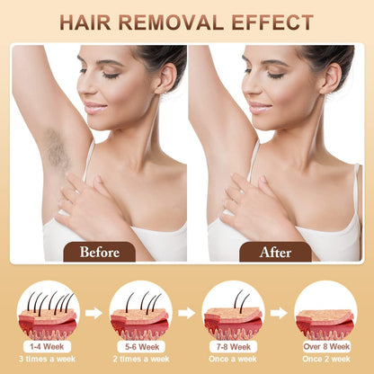 KIYORA Beauty™  IPL Laser Hair Removal